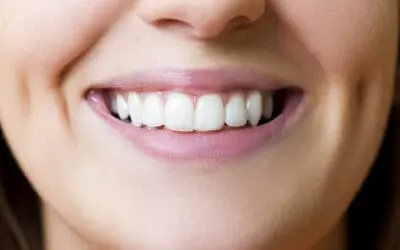 Understanding the Veneer Implant Process With Cosmetic Dentists