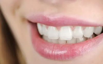 What an Invisalign Dentist Looks for During Your Smile Consultation