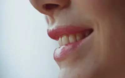 Adult Clear Aligners: How to Straighten Your Teeth Without Changing Your Lifestyle