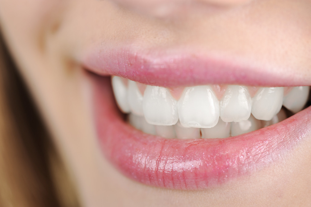 invisalign dentist